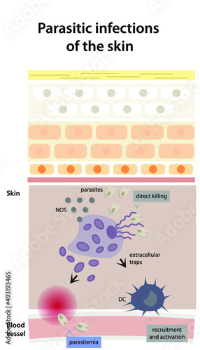 Scheme of parasitic infection development. Processes of parasitemia, recruitment and activation.