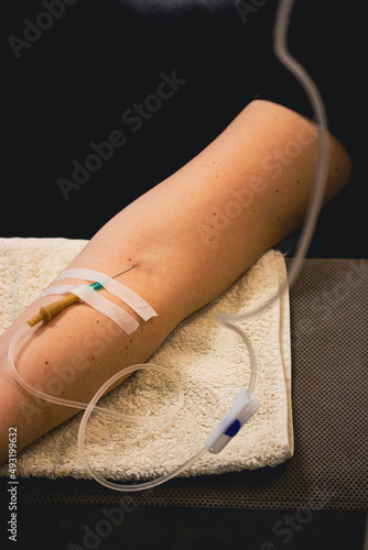 Woman's hand with catheter for dropper, butterfly needle used to draw blood from a vein or to deliver intravenous therapy to vein. Thin needle, flexible transparent tubing. Patient in nmedical clinic. photo