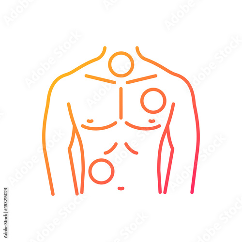 Metastases gradient linear vector icon. Chest cancer. Thorax and lungs tumors. Spreading of cancer. Pathogenic cells. Thin line color symbol. Modern style pictogram. Vector isolated outline drawing