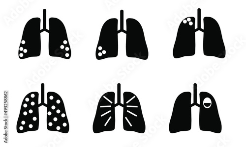 icon of lung pathology in black and white