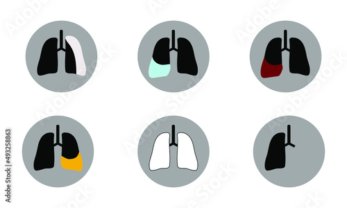 icon of lung and pleural pathology photo