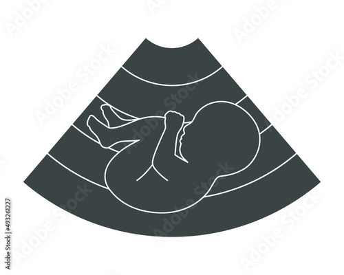 Fetus ultrasound graphic icon. Symbol ultrasound examination pregnancy. Sign isolated on white background. Vector illustration