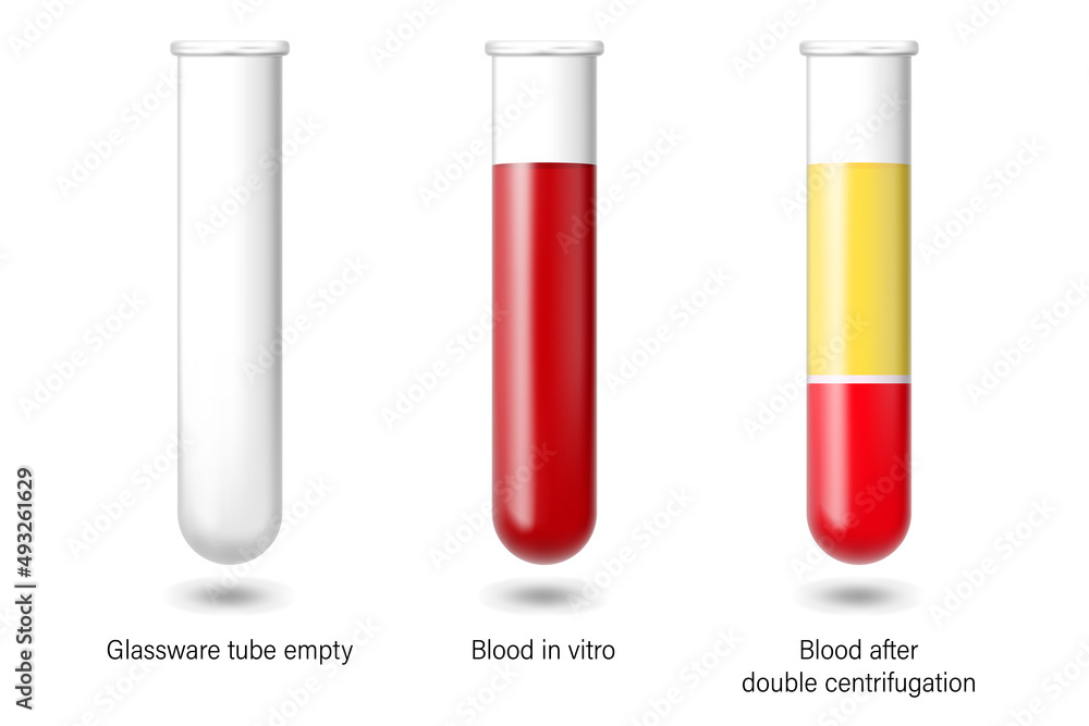 Glassware tube empty, blood in vitro and blood after double