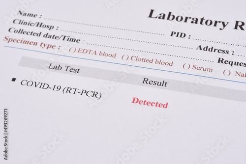 COVID-19 detected, laboratory report of COVID-19 testing by using RT-PCR method, the result showed detected or positive, sample from nasopharyngeal swab  photo