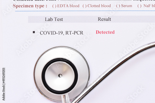 COVID-19 detected, laboratory report of COVID-19 testing by using RT-PCR method, the result showed detected or positive, sample from nasopharyngeal swab  photo