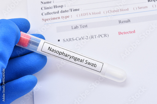 COVID-19 detected, laboratory report of COVID-19 testing by using RT-PCR method, the result showed detected or positive, sample from nasopharyngeal swab  photo