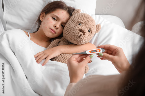 Cuadro en lienzo Woman measuring temperature of her little girl ill with chickenpox at home