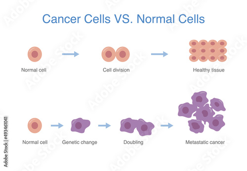 Compare between devenlop of healthy cell and cancer cell. Medical and science diagram about abnormal cells grow.