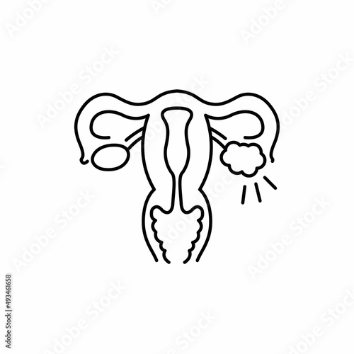 Polycystic ovary syndrome line color icon. Female reproductive system disease