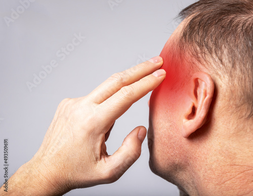 Man massaging temples. Headache, migraine, fatigue, health problems concept. Head back with red spot closeup. High quality photo
