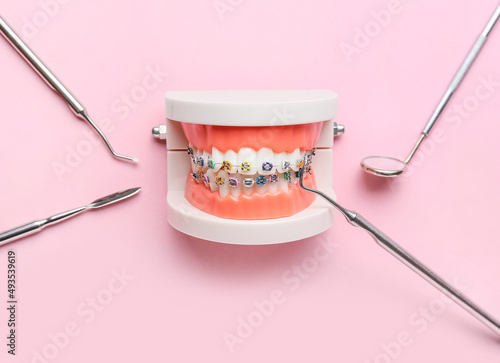 Model of jaw with dental braces and dentist tools on pink background