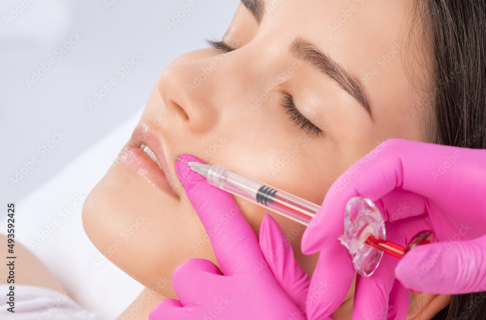 Cosmetologist does injections for lips augmentation and anti wrinkle in the nasolabial folds of a beautiful woman. Women's cosmetology in the beauty salon. Cosmetologist does injections for lips augmentation and anti wrinkle in the nasolabial folds of a beautiful woman. Women's cosmetology in the beauty salon.