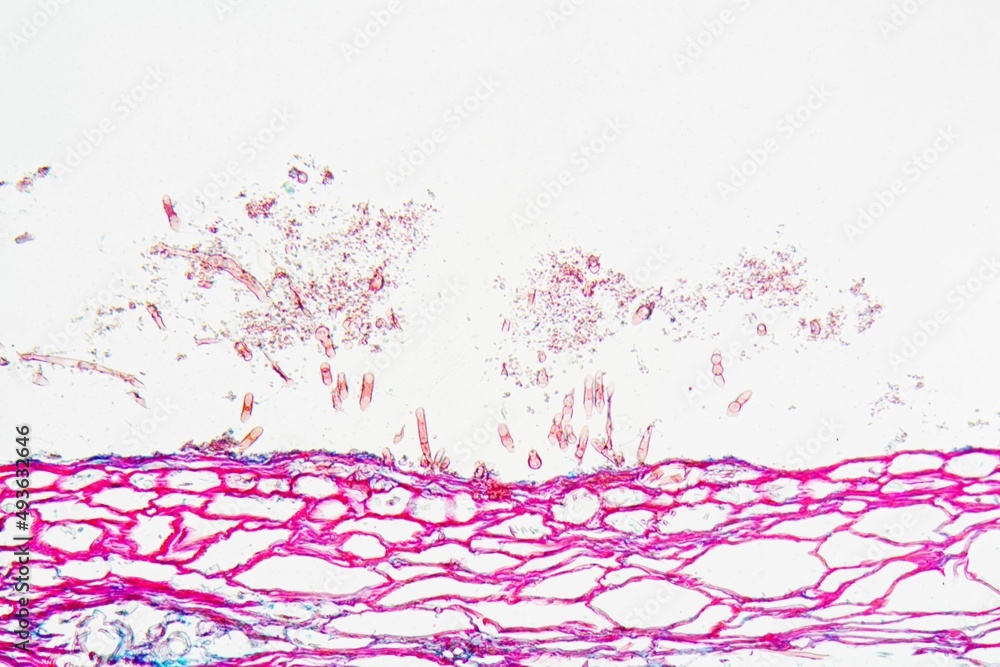 Obraz premium Botrytis allii under the microscope
