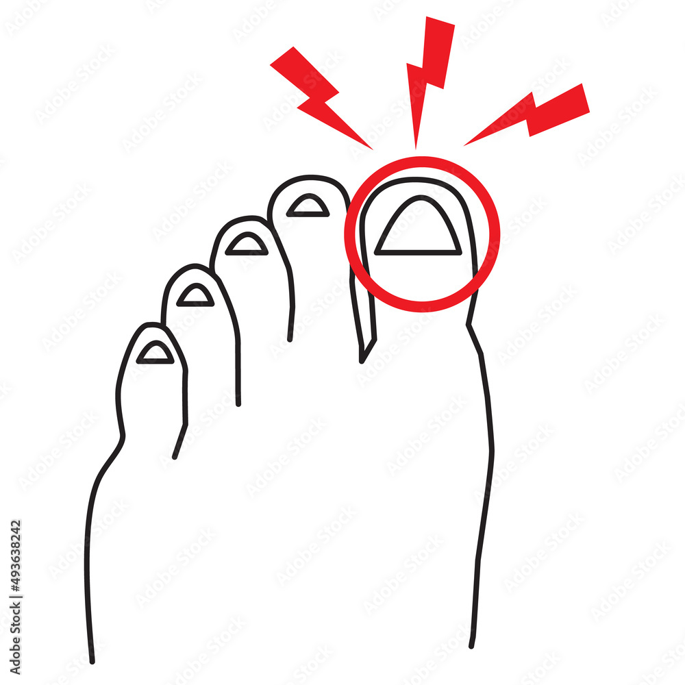 sore big toe icon pn white background. foot pain sign. leg with a toe ...