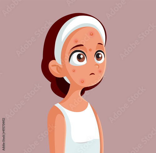 Upset Teenage Girl Suffering from Severe Acne Vector Illustration