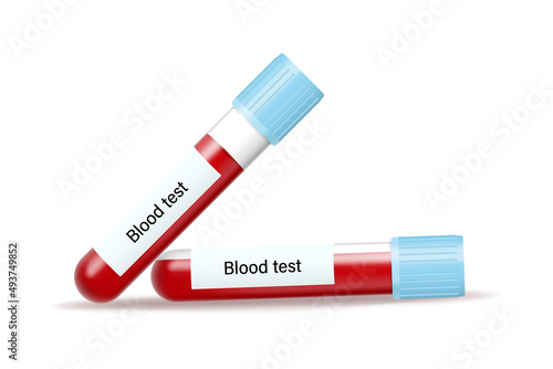 Blood test. Blood in vitro. Medical laboratory.
