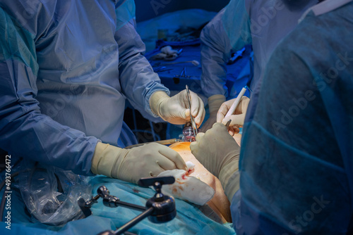 Surgeon's hands at work in the operating room