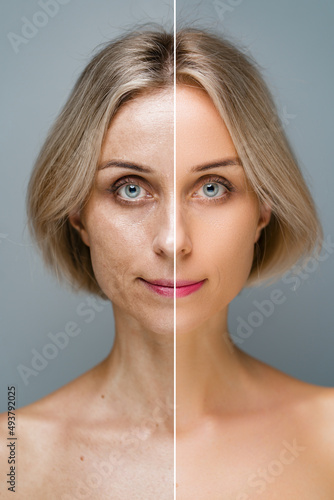 Before and after. Natural beauty. Blonde woman. No makeup. Grey background.