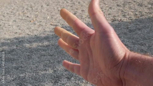 Hands of a person with Raynaud syndrome during an attack. photo