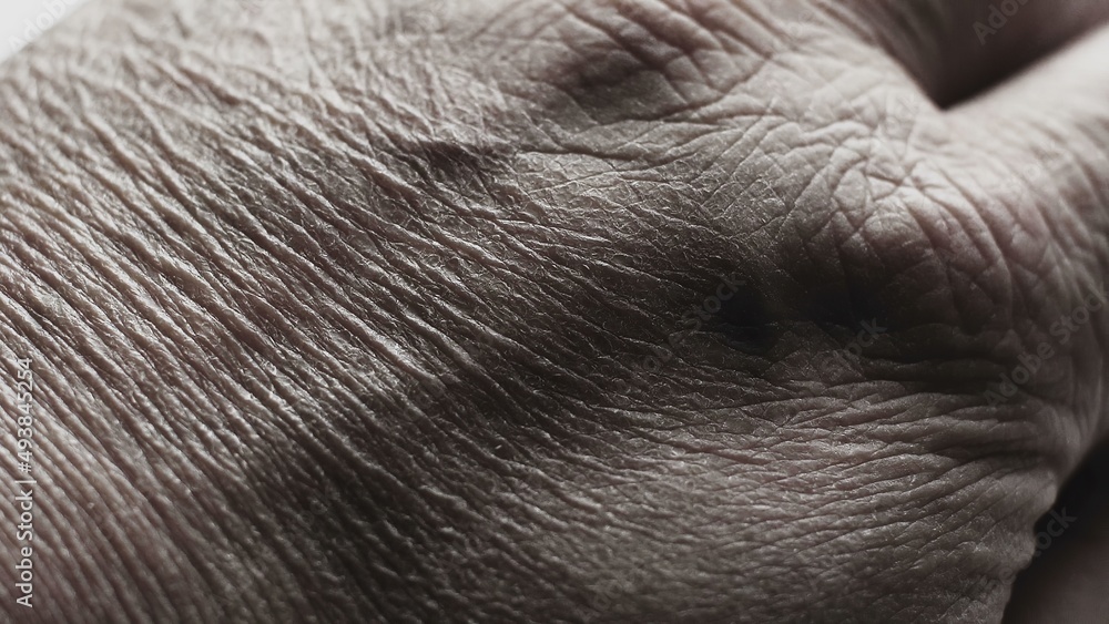Close Up Of Senior's Hands With Alzheimer Disease Close Up Of Senior's Hands With Alzheimer Disease