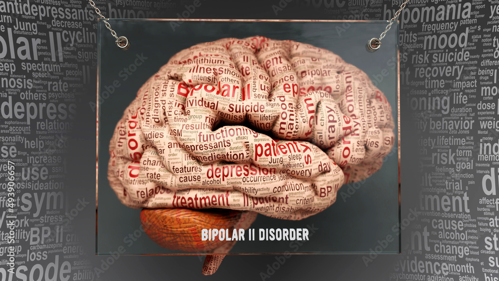 Bipolar ii disorder anatomy - its causes and effects projected on a ...