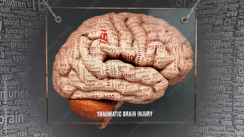 Traumatic brain injury anatomy - its causes and effects projected on a