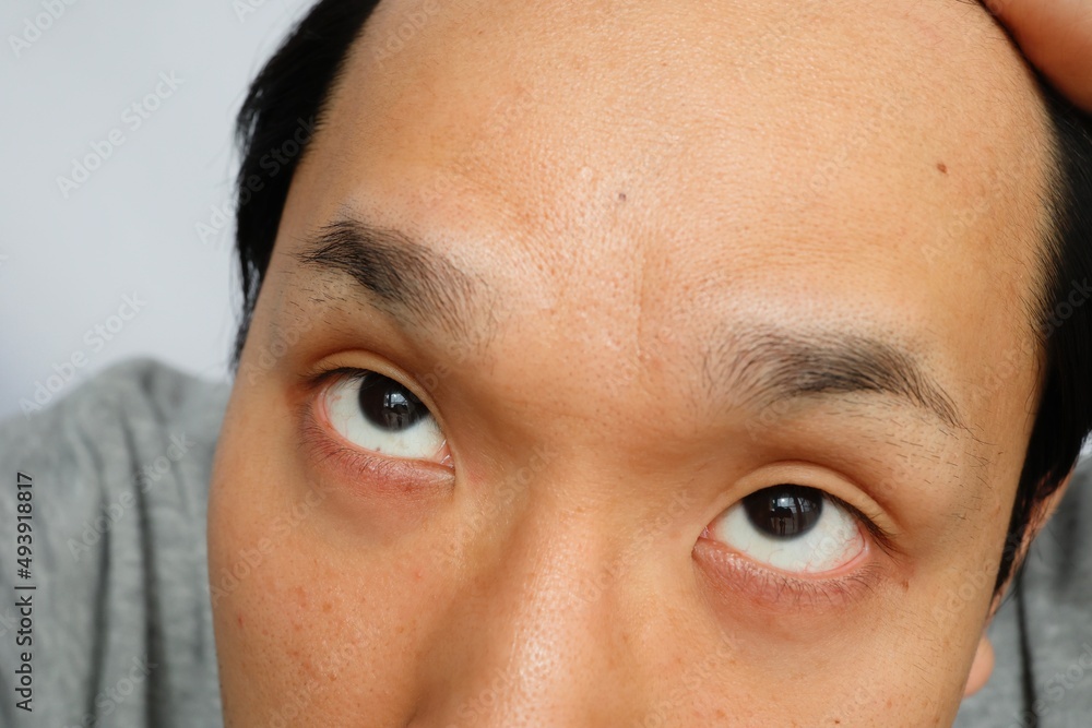 Fototapeta premium 日本人男性の額は広い