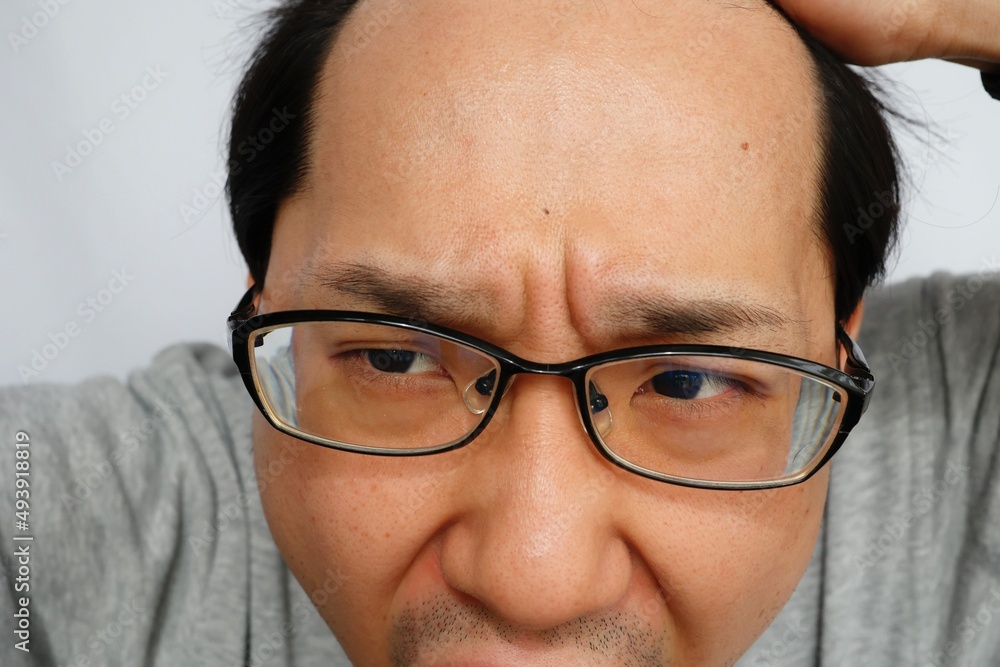 日本人男性の額は広い 日本人男性の額は広い