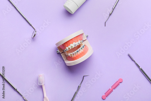 Model of jaw with dental braces and dentist tools on lilac background