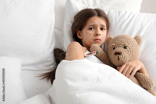 Little girl ill with chickenpox in bed