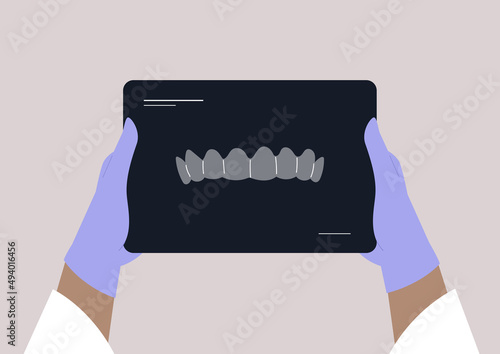 5 Teeth xray hands