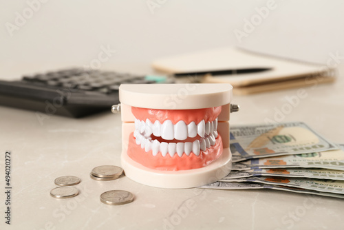 Educational dental typodont model and money on light grey table. Expensive treatment photo