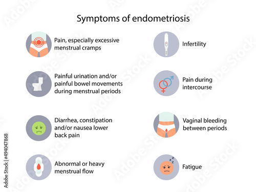 Endometriosis Symptoms Detailed vector infographic. Women Health