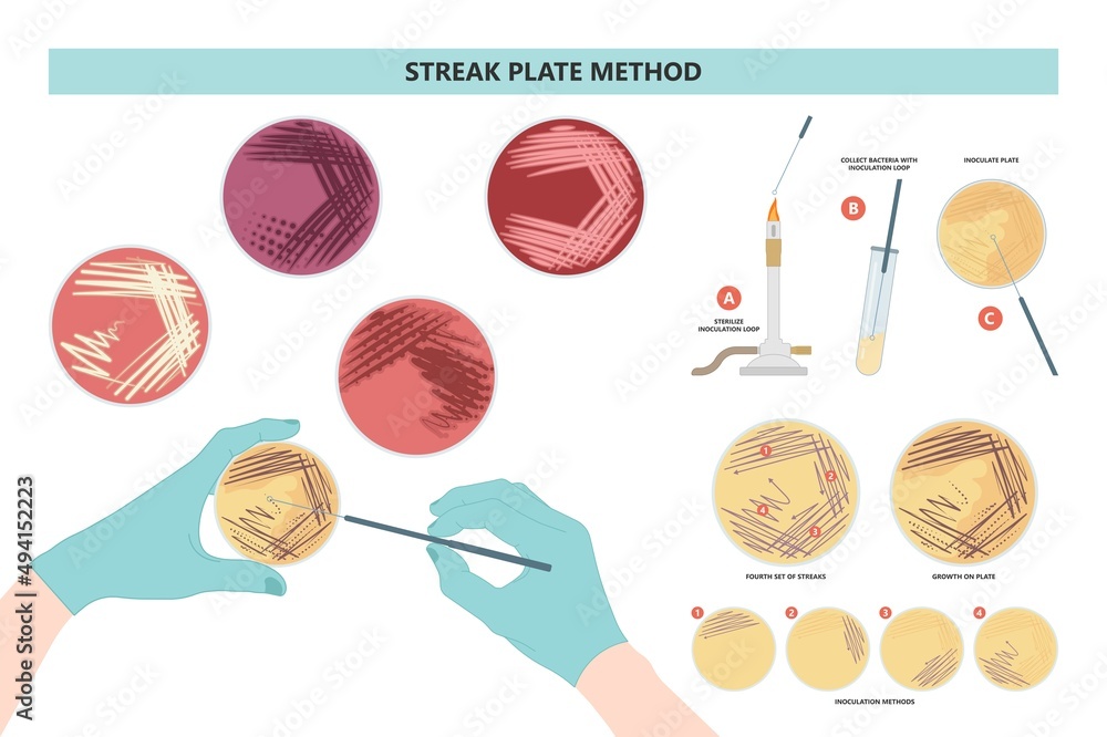 Agar plate method cell colony growth loop Bacteria Test blood stool