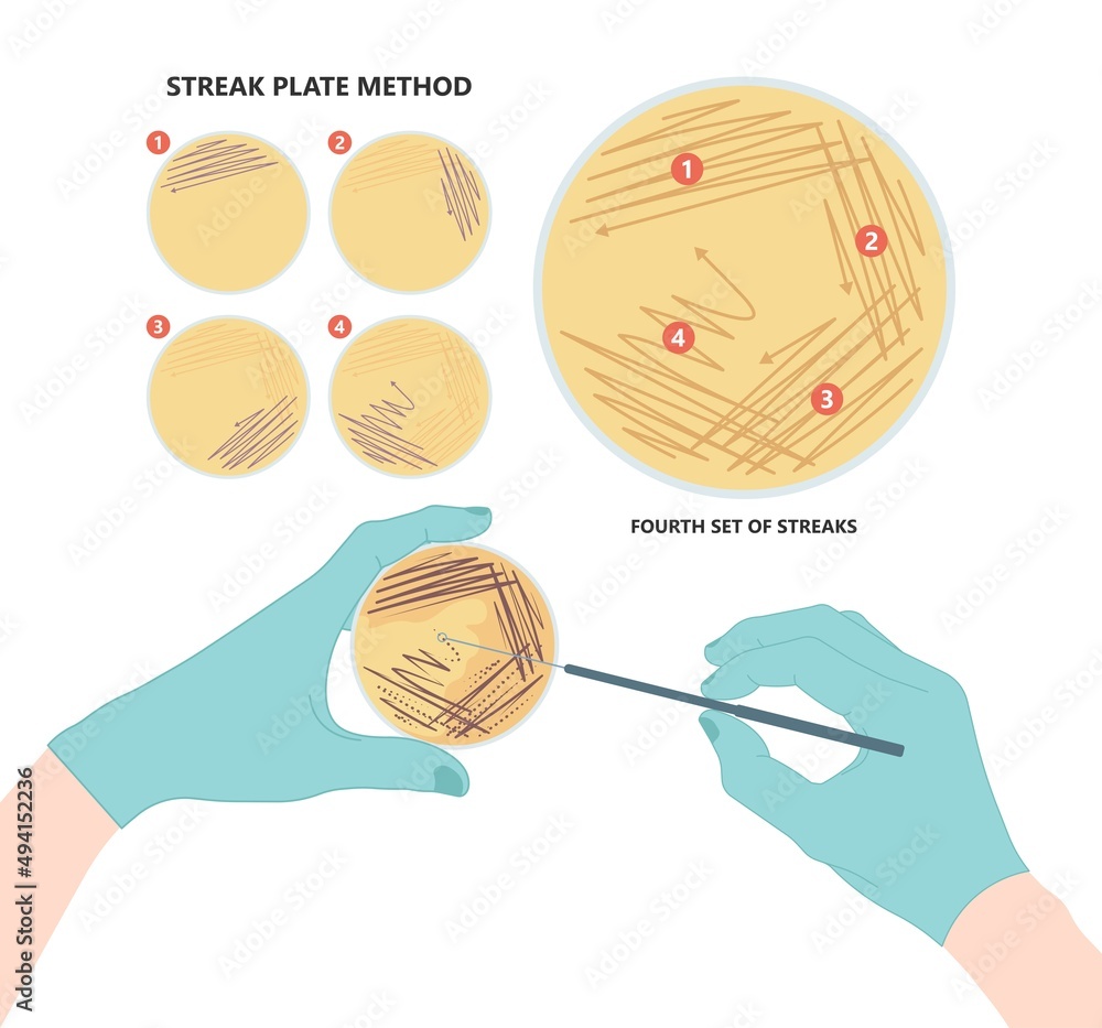 Agar plate method cell colony growth loop Bacteria Test blood stool