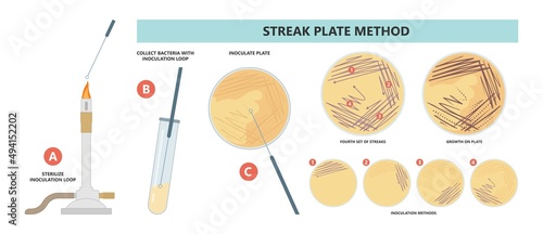 Agar plate method cell colony growth loop Bacteria Test blood stool urine mucus spinal fluid Sepsis Lab microbe fungi virus exam throat strep petri dish pour c diff germs Inoculate bacteriological