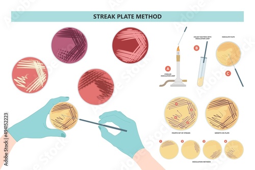 Agar plate method cell colony growth loop Bacteria Test blood stool urine mucus spinal fluid Sepsis Lab microbe fungi virus exam throat strep petri dish pour c diff germs Inoculate bacteriological photo
