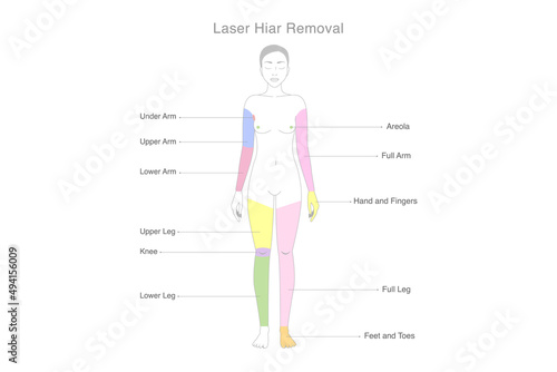 Highlight on woman's body area which popular to do laser hair removal treatments. Illustration about laser clinic diagram for beauty treatment.