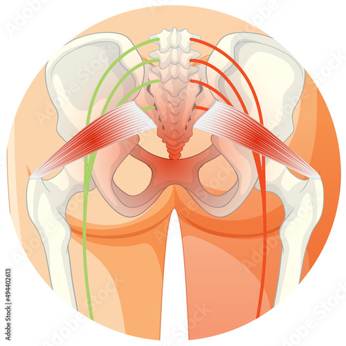 Lower back suffering from ankylosing spondylitis