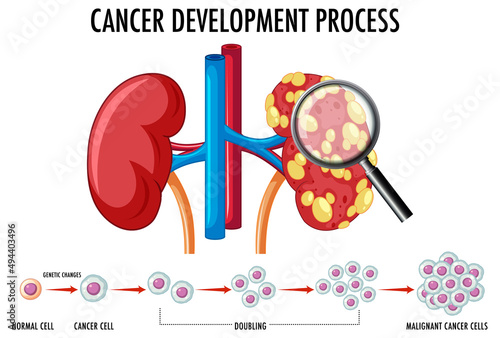 Diagram showing cancer development process