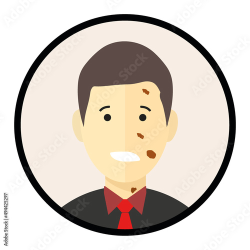 Melanoma and skin cancer awareness day in May. Flat icon with melanoma patient.