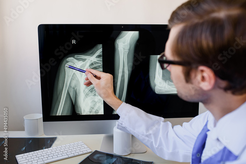 radiologist analyzing a patient arm and foream bones x ray.