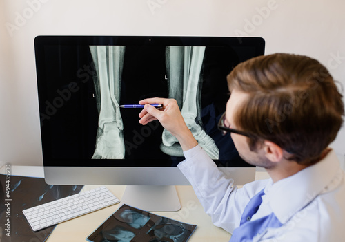 Quadro em tela Radiologist analyzing a football player patient x ray with a fibula fracture