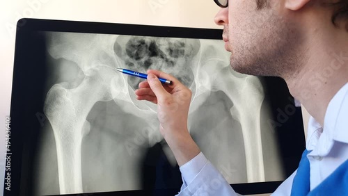 Doctor radiologist analysing a digital pelvic bones x ray on a computer.