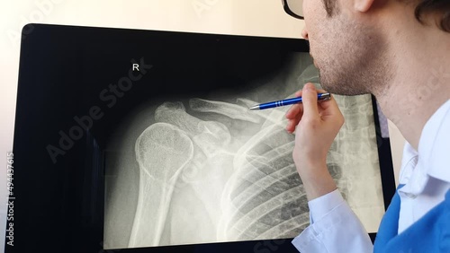 Man radiologist analysing a patient x ray with a clavicle fracture.