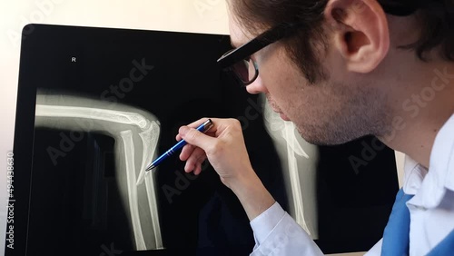Man radiologist analysing a patient child elbow bones x ray.
