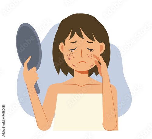 Acne skin problems Concept.Woman holding mirror is getting sad due to acne on her facial.Flat vecor cartoon character illustration.