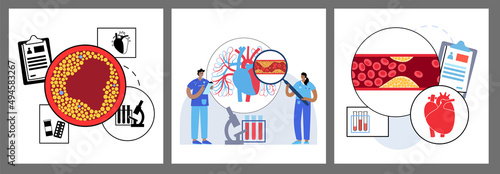 Cholesterol heart disease