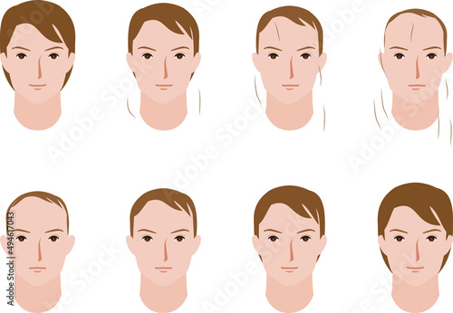 男性の毛量の増減するイラスト