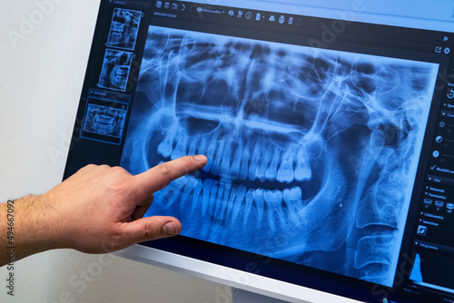 Dental overview on computer screen at a dental office